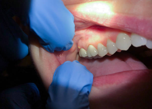 Best Orthodontic Emergency Dentist in Meadowbrook, CA